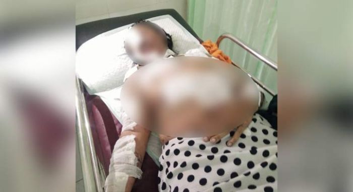 Kesal dan Merasa Tersaingi, Wanita di Tuban ini Nekat Bakar Diri dan Arahkan Api ke Warung Tetangga Kesal dan Merasa Tersaingi, Wanita di Tuban ini Nekat Bakar Diri dan Arahkan Api ke Warung Tetangga