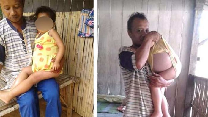 Bocah Penderita Gagal Ginjal Asal Pamekasan Butuh Bantuan Bocah Penderita Gagal Ginjal Asal Pamekasan Butuh Bantuan