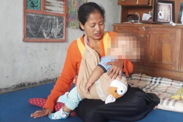 Terkendala Biaya, Balita Hidrosefalus di Jember Butuh Uluran Tangan, Sang Ayah Hanya Bisa Pasrah Terkendala Biaya, Balita Hidrosefalus di Jember Butuh Uluran Tangan, Sang Ayah Hanya Bisa Pasrah