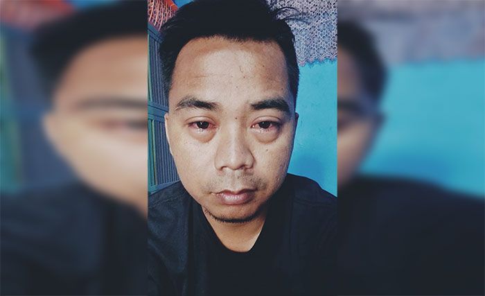 Pancaroba Sebabkan Penyakit Mata, Dinkes Sampang: Virus Biasa Pancaroba Sebabkan Penyakit Mata, Dinkes Sampang: Virus Biasa