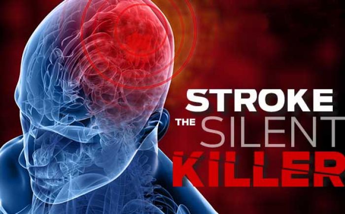 Puluhan Pasien Stroke di Pacitan Meninggal Dunia, Ini Cara Mencegahnya Puluhan Pasien Stroke di Pacitan Meninggal Dunia, Ini Cara Mencegahnya