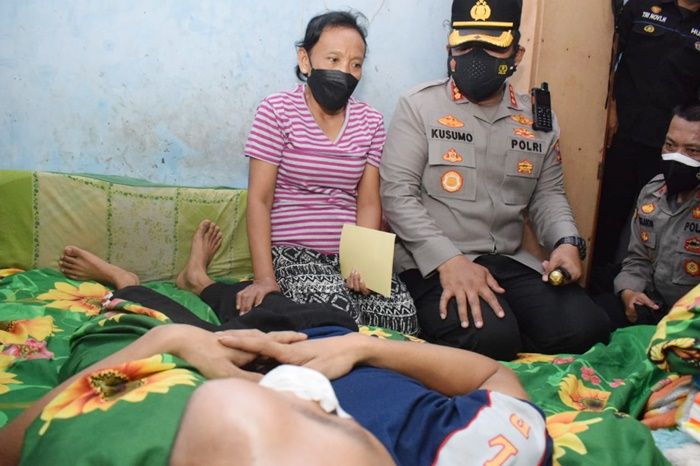 Prihatin, Kapolresta Sidoarjo Jenguk Warga Penderita Tumor Mata di Krian