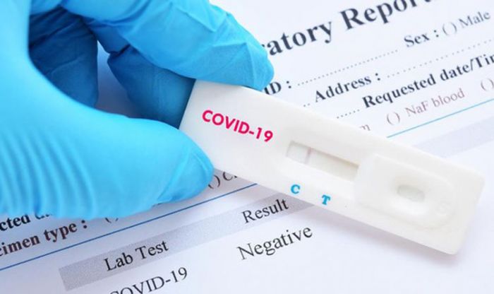 Gugas Percepatan Penanganan Covid-19 Pacitan Bantah Biaya Rapid Test Rp 300 ribu per Orang Gugas Percepatan Penanganan Covid-19 Pacitan Bantah Biaya Rapid Test Rp 300 ribu per Orang