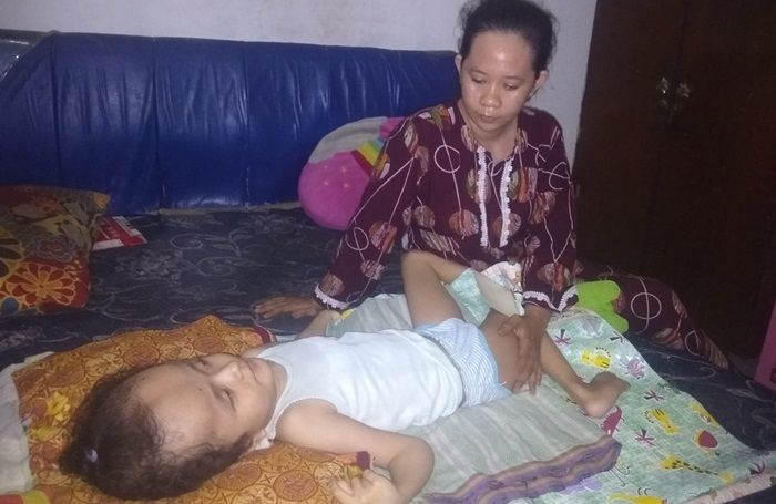 Ayo Bantu Sasa, Bocah Penderita Hidrosefalus di Sidoarjo yang Ditinggal Pergi Sang Ayah Ayo Bantu Sasa, Bocah Penderita Hidrosefalus di Sidoarjo yang Ditinggal Pergi Sang Ayah