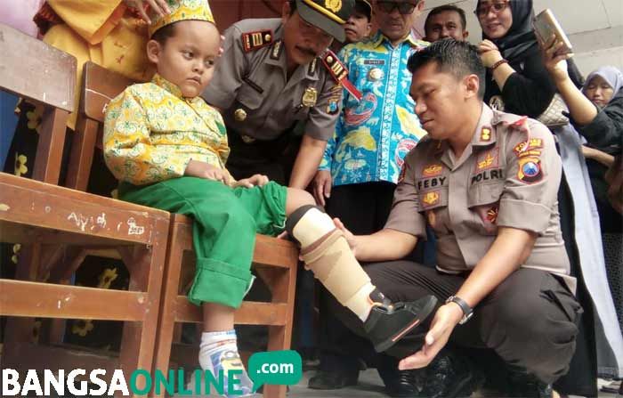 Kapolres Lamongan Berikan Bantuan Kaki Palsu kepada Siswa Disabilitas Kapolres Lamongan Berikan Bantuan Kaki Palsu kepada Siswa Disabilitas