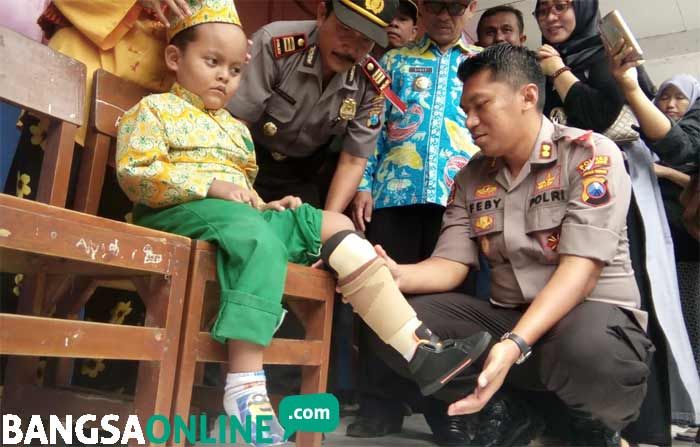 Kapolres Lamongan Berikan Bantuan Kaki Palsu kepada Siswa Disabilitas