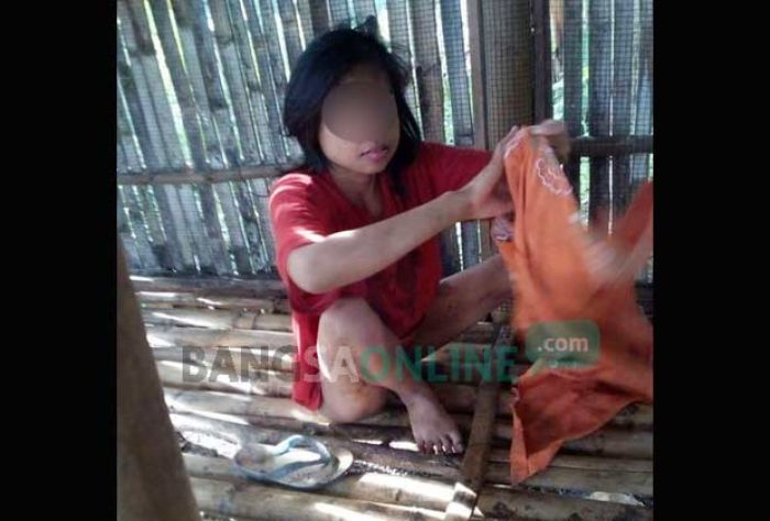 Kabupaten Blitar Belum Bebas Pasung, Dinas Sosial Kesulitan Bebaskan Kabupaten Blitar Belum Bebas Pasung, Dinas Sosial Kesulitan Bebaskan