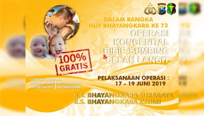 Polda Jatim Gelar Operasi Kongenital, Bibir Sumbing, dan Belah Langit-langit Gratis Polda Jatim Gelar Operasi Kongenital, Bibir Sumbing, dan Belah Langit-langit Gratis