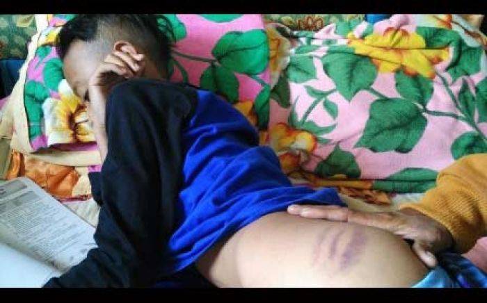 Guru di Lumajang Pukul Murid hingga Lebam, Orang Tua Lapor Polisi