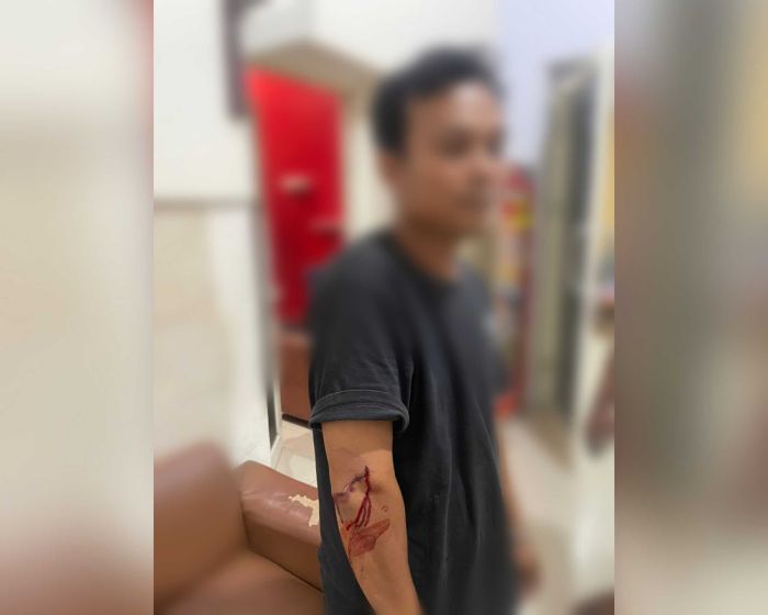 Diduga Dipicu Klakson, Pria di Waru Sidoarjo Sabet Pengendara Mobil dengan Celurit