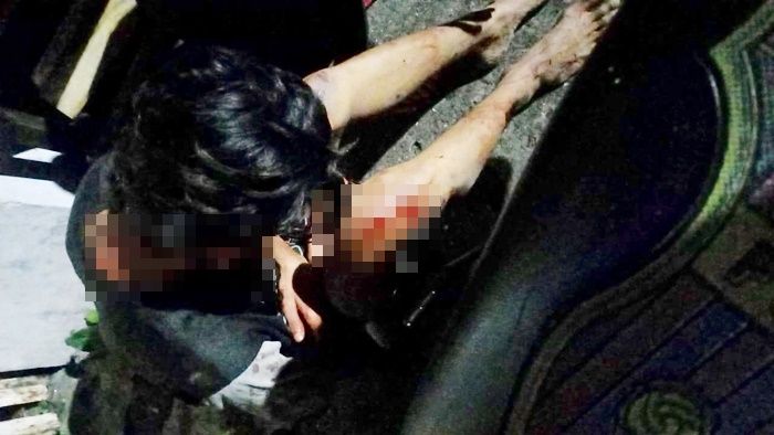 Geng Motor Resahkan Warga Surabaya, Bacok Telinga dan Rampas Motor Korban Geng Motor Resahkan Warga Surabaya, Bacok Telinga dan Rampas Motor Korban