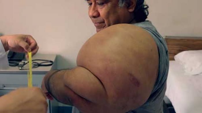 Popeye itu Nyata! Dia Hidup di Peru Popeye itu Nyata! Dia Hidup di Peru