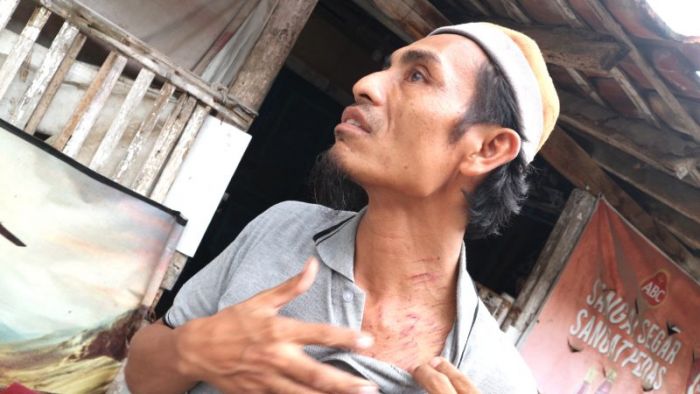 Aniaya Pedagang Mi Ayam, Kepala Pasar Kolpajung Dilaporkan ke Polisi Aniaya Pedagang Mi Ayam, Kepala Pasar Kolpajung Dilaporkan ke Polisi