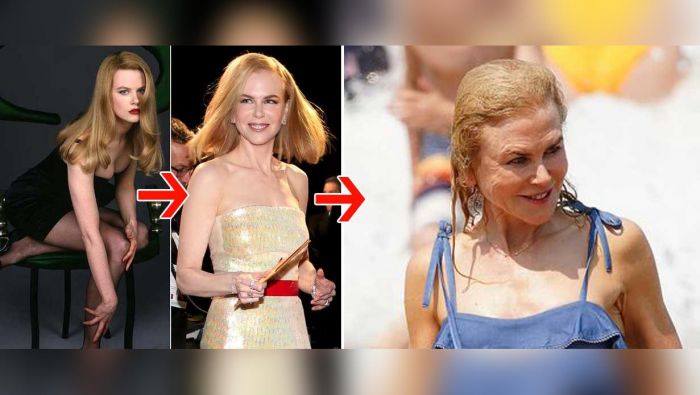 Menua, Kulit Nicole Kidman Keriput dan Kendor di Sana-sini Menua, Kulit Nicole Kidman Keriput dan Kendor di Sana-sini