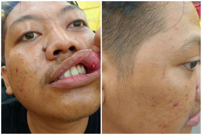 Kasus Dugaan Penganiayaan Jurnalis Beritajatim oleh Polisi Jalan di Tempat, KAJ Tegaskan Hal ini Kasus Dugaan Penganiayaan Jurnalis Beritajatim oleh Polisi Jalan di Tempat, KAJ Tegaskan Hal ini