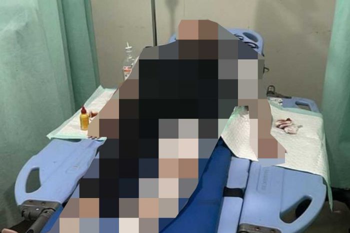 Diduga Jadi Korban Jambret, Wanita Paruh Baya Ditemukan Tergeletak di Depan Mall Grand City Surabaya Diduga Jadi Korban Jambret, Wanita Paruh Baya Ditemukan Tergeletak di Depan Mall Grand City Surabaya
