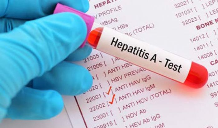 Dua Warga di Kelurahan Baleharjo Pacitan Negatif dari Hepatitis A Dua Warga di Kelurahan Baleharjo Pacitan Negatif dari Hepatitis A