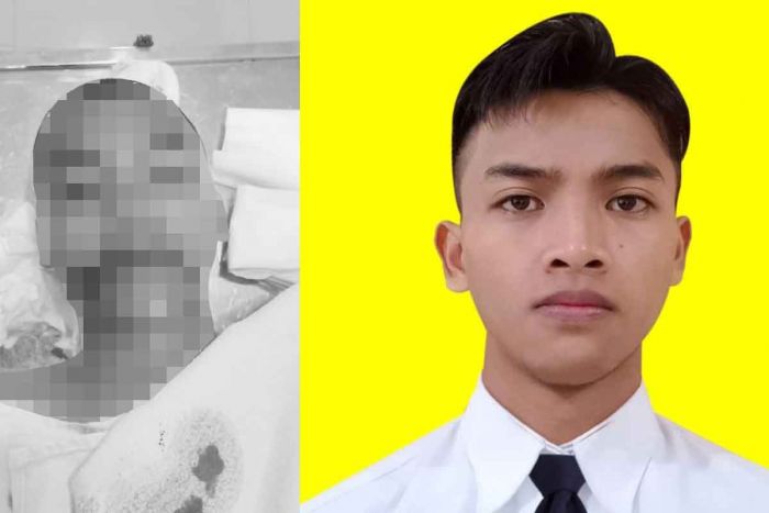Diduga Dianiaya Senior, Siswa Poltekpel Surabaya Meninggal Dunia Babak Belur Diduga Dianiaya Senior, Siswa Poltekpel Surabaya Meninggal Dunia Babak Belur