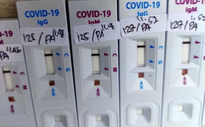Buntut Adanya Pejabat Konfirm Positif Covid-19, Sebanyak 54 ASN Pemkot Batu Di-rapid Test Buntut Adanya Pejabat Konfirm Positif Covid-19, Sebanyak 54 ASN Pemkot Batu Di-rapid Test