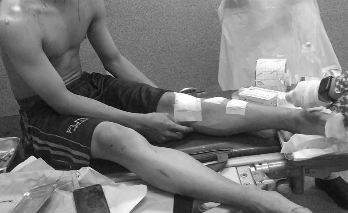 2 Remaja Perguruan Silat Jadi Korban Pengeroyokan di Porong Sidoarjo 2 Remaja Perguruan Silat Jadi Korban Pengeroyokan di Porong Sidoarjo