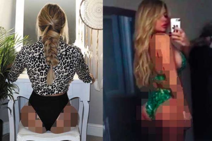 Menderita Sindrom Dysmorphia, Bokong Bianca Gascoigne Dipermak Jadi Bulat Berisi Menderita Sindrom Dysmorphia, Bokong Bianca Gascoigne Dipermak Jadi Bulat Berisi
