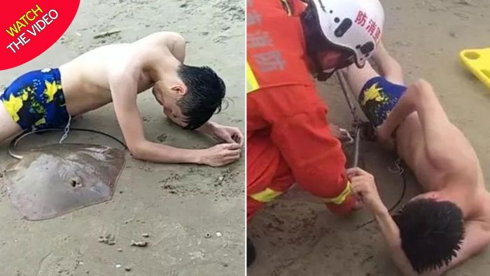 Berenang di Laut, Penis ABG Disengat Duri Ikan Pari