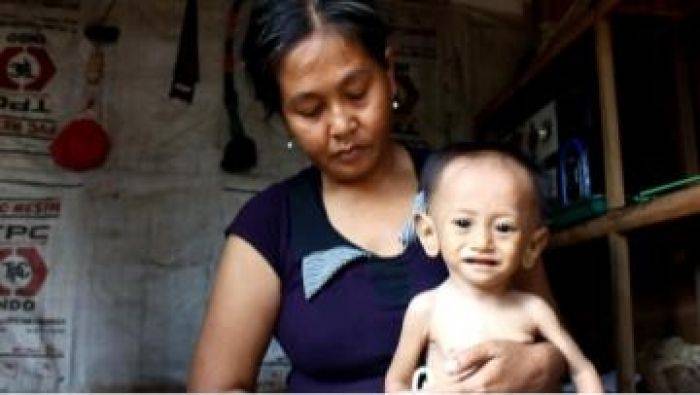 Balita di Nganjuk Alami Gizi Buruk Ortu Tak Bisa Manfaatkan Jamkesda karena Pengamen Balita di Nganjuk Alami Gizi Buruk Ortu Tak Bisa Manfaatkan Jamkesda karena Pengamen