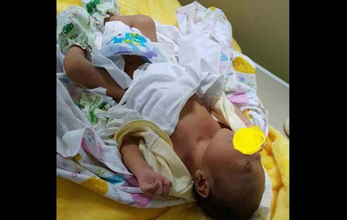 Cacat Lahir, Orang Tua Tega Buang Bayi di atas Mobil Pikap Cacat Lahir, Orang Tua Tega Buang Bayi di atas Mobil Pikap