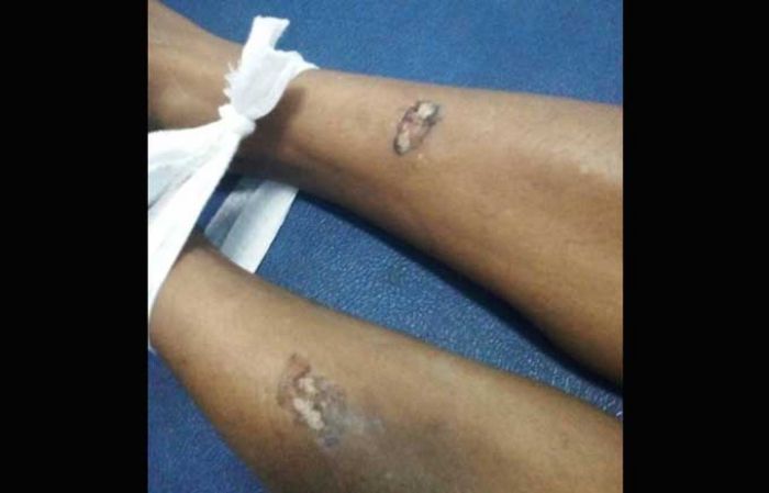 Pasang Terop, Pemuda Asal Paron Tewas Tersengat Listrik Tegangan Tinggi Pasang Terop, Pemuda Asal Paron Tewas Tersengat Listrik Tegangan Tinggi