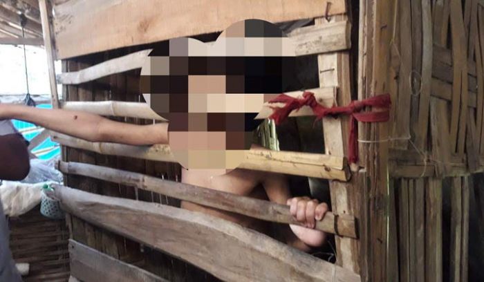 Bocah Idap Gangguan Jiwa di Pamekasan yang Dikurung Dapat Pengobatan Gratis dari RSUD Bocah Idap Gangguan Jiwa di Pamekasan yang Dikurung Dapat Pengobatan Gratis dari RSUD