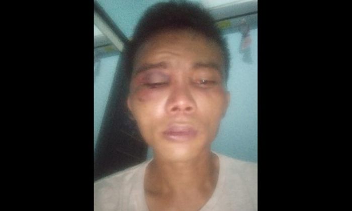 Diduga Ada Keterlibatan Oknum, Kuasa Hukum Korban Penganiayaan: Penanganan Terkesan "Lemot" Diduga Ada Keterlibatan Oknum, Kuasa Hukum Korban Penganiayaan: Penanganan Terkesan "Lemot"