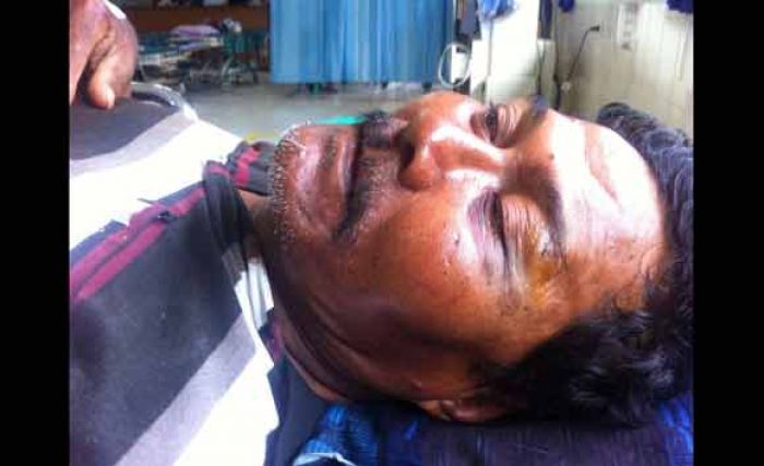 Warga Karangagung Dikeroyok 6 Orang Misterius Warga Karangagung Dikeroyok 6 Orang Misterius
