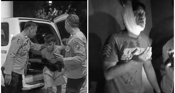 Ditangkap Massa, Jambret di Kedungdoro Surabaya Babak Belur