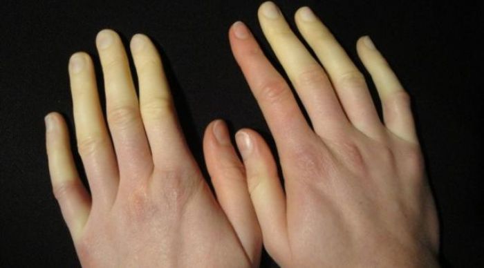 10 Sinyal Bahaya dari Tubuh, Jangan Dibiarkan 10 Sinyal Bahaya dari Tubuh, Jangan Dibiarkan