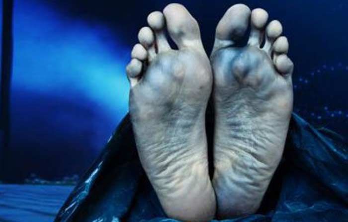 Penggali Kubur di Lamongan Disambar Petir: 1 Meninggal, 3 Orang Luka Bakar Penggali Kubur di Lamongan Disambar Petir: 1 Meninggal, 3 Orang Luka Bakar