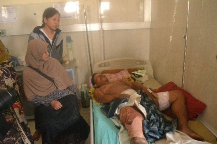 Usir Perampok, Warga Lumajang Terkena Lemparan Bondet