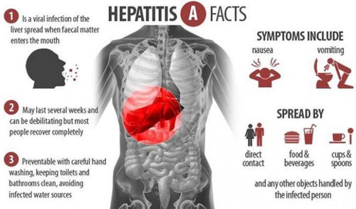 Jumlah Pasien Hepatitis A di Pacitan Capai 1102 Orang