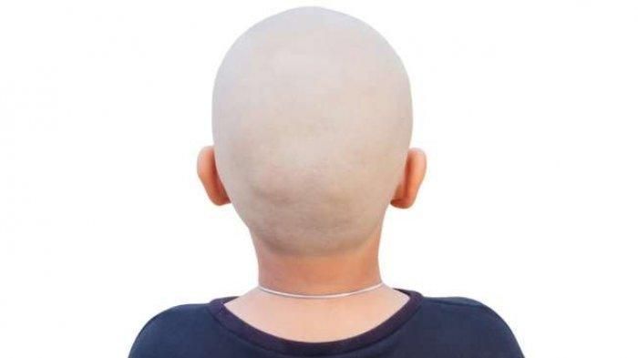 Wujud Syukur Dijatuhkannya Sanksi ke Bupati Jember, Puluhan Aktivis GRJ Cukur Gundul Wujud Syukur Dijatuhkannya Sanksi ke Bupati Jember, Puluhan Aktivis GRJ Cukur Gundul