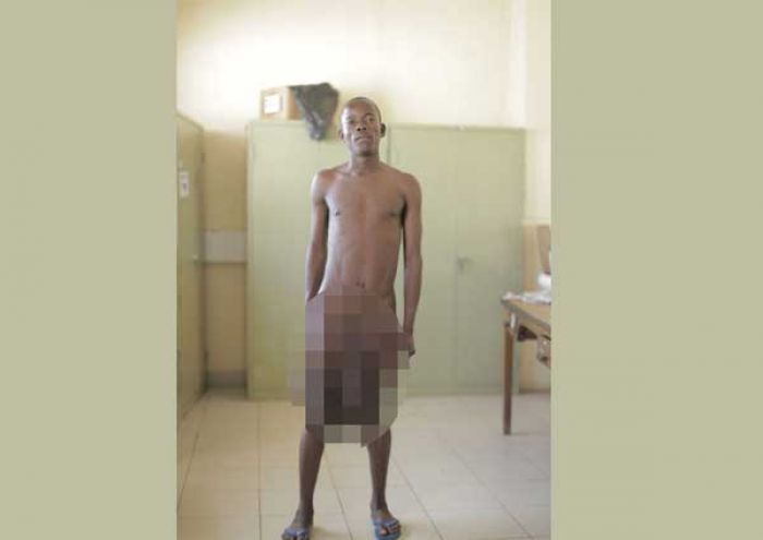 ABG Ini Punya Penis Sepanjang 1 Meter, Bukan Senang, Malah Ngaku Tersiksa ABG Ini Punya Penis Sepanjang 1 Meter, Bukan Senang, Malah Ngaku Tersiksa