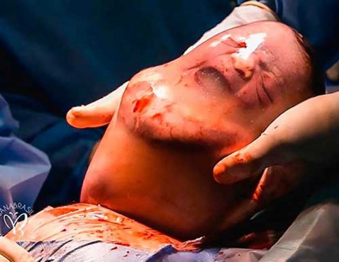Masya Allah, Bayi Lahir Terlindung Selaput Ketuba, Merasa Nyaman dan Berbaring Nyaman Masya Allah, Bayi Lahir Terlindung Selaput Ketuba, Merasa Nyaman dan Berbaring Nyaman