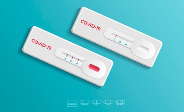 Masuk Kota Batu, Wisatawan Wajib Tunjukkan Hasil Rapid Test Nonreaktif Masuk Kota Batu, Wisatawan Wajib Tunjukkan Hasil Rapid Test Nonreaktif