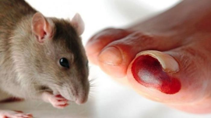 Serangan Leptospirosis Renggut Satu Korban Jiwa di Pacitan Serangan Leptospirosis Renggut Satu Korban Jiwa di Pacitan