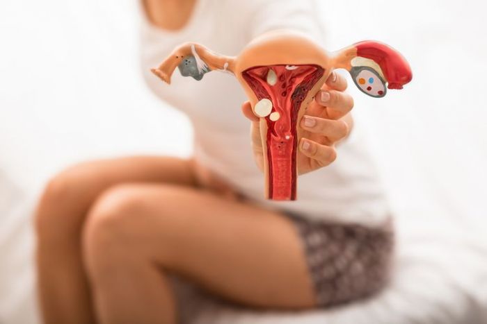 Benarkah Gangguan Haid dan Obesitas Bisa Picu PCOS? Ini Penjelasannya Benarkah Gangguan Haid dan Obesitas Bisa Picu PCOS? Ini Penjelasannya