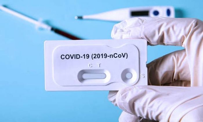 Update: Positif Covid-19 di Gresik Tambah 19 Orang, Sembuh 21 Update: Positif Covid-19 di Gresik Tambah 19 Orang, Sembuh 21