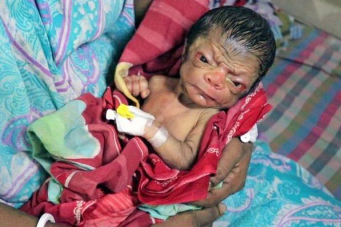 Allahu Akbar! Bayi Lahir dengan Wajah Usia 80 Tahunan Allahu Akbar! Bayi Lahir dengan Wajah Usia 80 Tahunan