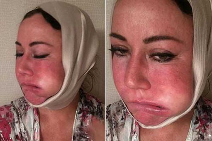 Mulut Artis Lisa Appleton Bengkak Penuh Nanah, Berbau seperti Tikus Mulut Artis Lisa Appleton Bengkak Penuh Nanah, Berbau seperti Tikus