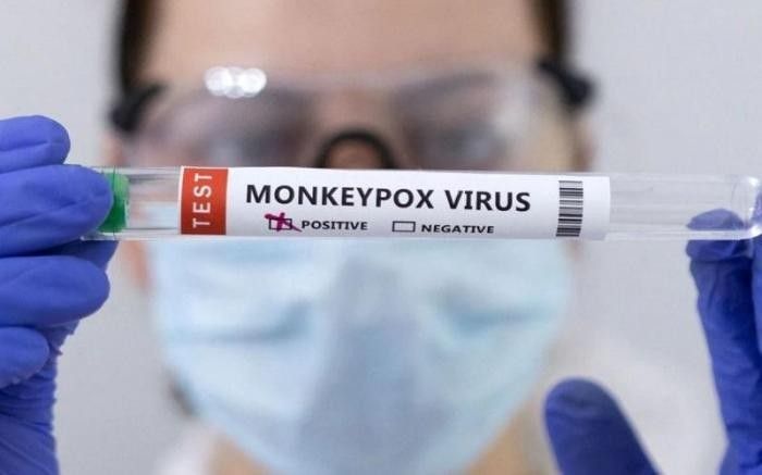 Ketahui 5 Cara Penularan Mpox yang Perlu Diwaspadai Ketahui 5 Cara Penularan Mpox yang Perlu Diwaspadai