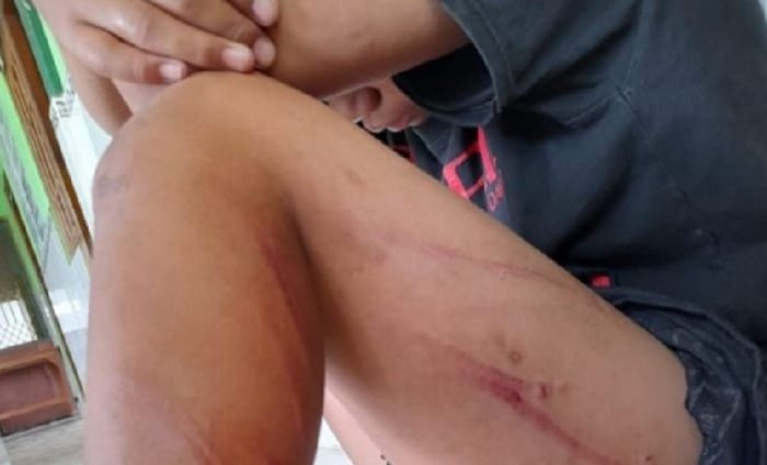 Anak Yatim Korban Penganiayaan di Gresik, Kini Tinggal di Rumah Kos Sempit Bersama Ibu dan Neneknya Anak Yatim Korban Penganiayaan di Gresik, Kini Tinggal di Rumah Kos Sempit Bersama Ibu dan Neneknya
