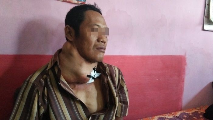 Derita Sukadi, ​Warga Miskin Penderita Tumor Ganas di Kesamben Jombang