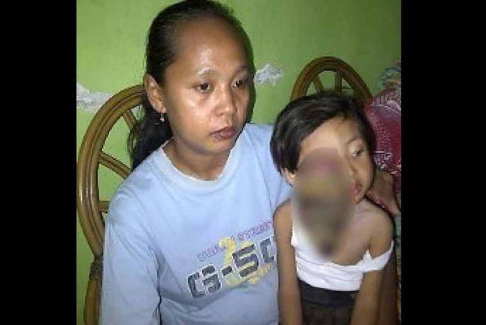 Bocah Penderita Tumor Mata di Mojokerto Akhirnya Meninggal Bocah Penderita Tumor Mata di Mojokerto Akhirnya Meninggal